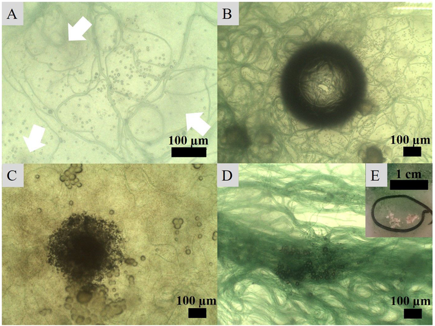 Microscopic view of ice crystal formation initiating around a nucleation particle in water.